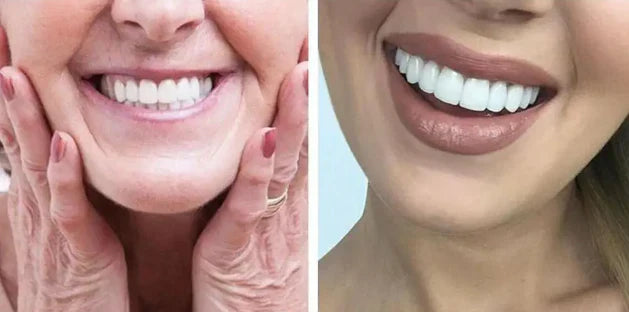 FlexiSmile Sonrisa Instantánea Carillas Dentales Adaptables🦷